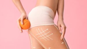 scopri come combattere la cellulite