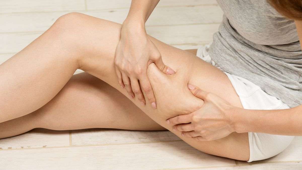 scopri come eliminare la cellulite e la ritenzione idrica