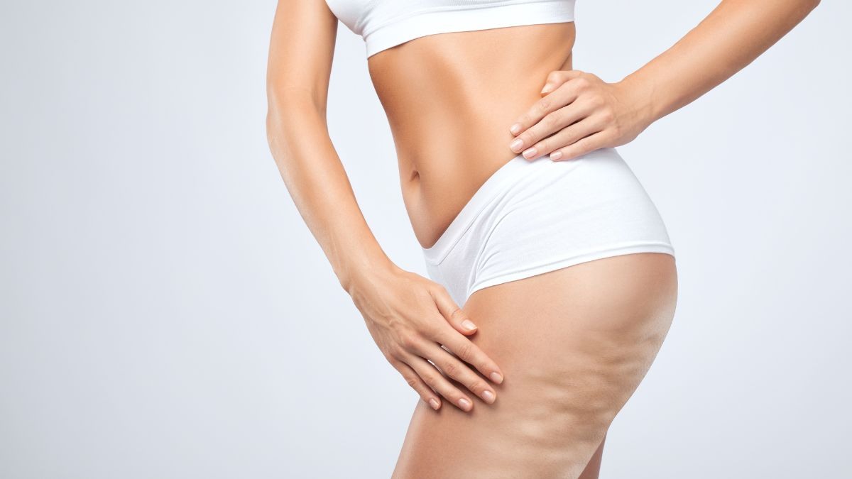 quali sport sono adatti a ridurre la cellulite